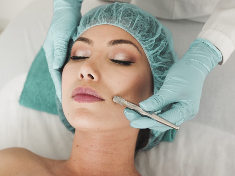Dermal filler treatment for facial contouring
